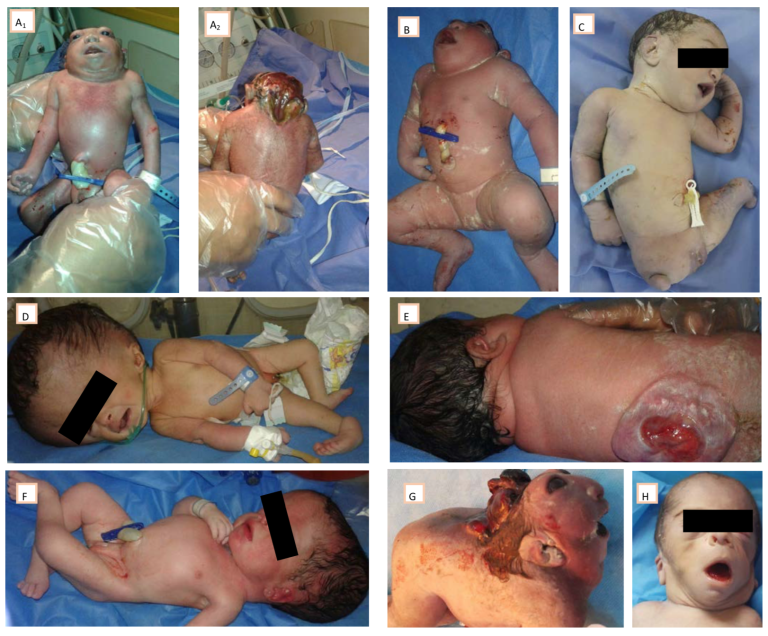 infant victims of US military toxic pollution in Iraq